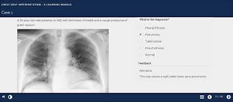 Image result for XRay Interpretation
