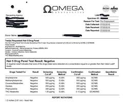 What's the detection window for hair drug test? Pin On Drug Test
