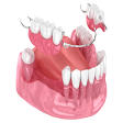 Fixed Partial Denture Treatment product image