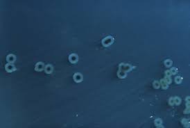 Salmonella bacteria typically live in animal and human intestines and are shed through feces. Salmonella Enterica Wikipedia