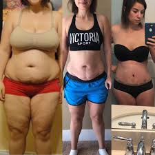 Let S Talk Tata S How Extreme Weight Loss Affected My Breasts Instant Loss Conveniently Cook Your Way To Weight Loss