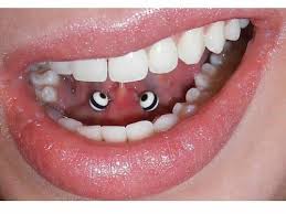 Piercing De Ceja Acero Quirurgico Bolas Con Espiral Piercing Piercing Frenillo Piercing Para Lengua