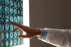 Brain cancer can arise from many different types of brain cells (primary brain cancer) or occur when cancer cells type of brain cancer indicates what kind of brain cells that gave rise to the tumor. Promising Approaches In The Battle Against Brain Metastasis Meduni Vienna