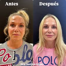 Dra Justina Lopez /medicina