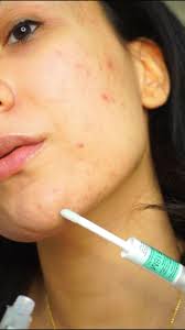 Spot Prone Skin Affordable Skincare Routine @Maia Gray