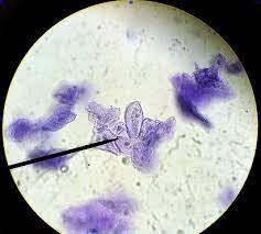 <br> (ii) in a plant cell, nucleus is usually located on one side of cell, whereas, in an animal cell, it is usually located in the centre of the cell. Cell Organelles Cells The Basic Units Of Life Siyavula