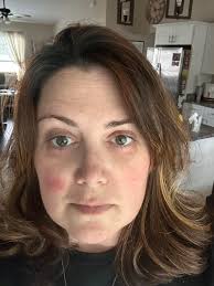 Eye drops for temporary redness removal