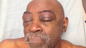 Deaf man given $175,000 settlement after claiming Oklahoma troopers used  excessive force during arrest