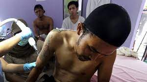 Carecen sf's tattoo removal clinic provides this service free of charge. Memorize Qur An Chapter Get Free Tattoo Removal About Islam