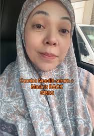 Serum Jarum Susuk TMF dan Mask Menggoda