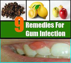 Pin On Hygiene Remedies
