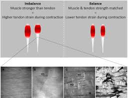 Imbalances In Muscle And Tendon Strength And The Relation