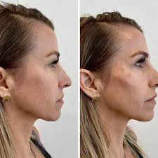 TOP 10 BEST Prp Hair Restoration in Carlsbad, CA