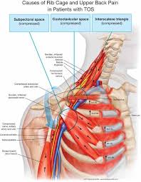 Slipping rib syndrome's connection to the thoracic spine and pain. Do You Have Cell Phone Text Neck Pain Syndrome Or Smartphone Shoulder Pain Syndrome