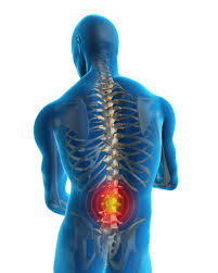 Maybe you would like to learn more about one of these? Disc Herniation And Slipped Disc Treatment In Singapore