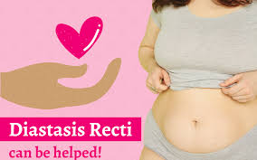 Maybe you would like to learn more about one of these? Diastasis Recti Can Be Helped Dr Amruta Inamdar Pelvic Floor Physical Therapy