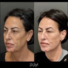 Aspinder Singh MD MBA