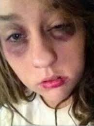 Shreveport Air Force senior airman speaks out against domestic violence