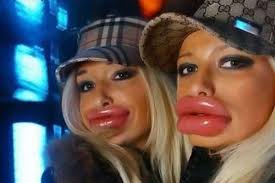 Sooo This Is Where The Term Duck Lip Came From Plastic Surgery Photoshop Fail Duck Face