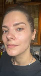 SkinSo⁵² by Marija