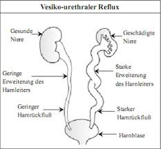 Harnwegsinfektionen Bei Kindern Urinary Tract Infection In Children Uti In Children In German
