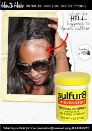 ɞღ♥♡ *please read the details below* ♡♥ღɞ where to purchase sulfur powder: Regrow Bald Edges Avoid Premature Baldness Hueknewit Com