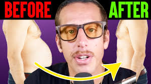 🔥 I used to be obese, depressed, and