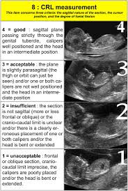 Quality Of First Trimester Measurement Of Crown Rump Length