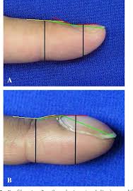 Image result for Digital Clubbing