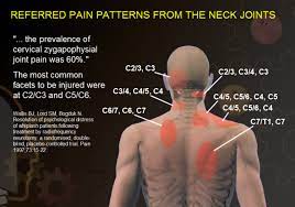 Facet Pain 770 469 7330