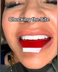 Davidson Dental (@ddsdavidsondental) · Silver Spring, MD