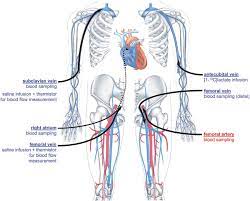 Position And Function Of The Catheters Download Scientific Diagram