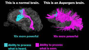 Asperger's syndrome (as) or a little professor syndrome has been known for more than 50 years ago. I M Programmer Do I Have Asperger S Syndrome Work N Me