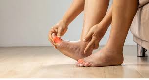 Image result for gout