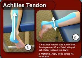To rub/stroke someone to cause them pleasure, see massage, foreplay. Resources Rock Tape Taping Rehab Achilles Achilles Tendonitis Kinesiology Taping