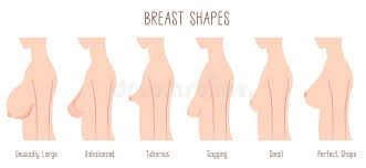 Breast Shape Chart Stock Illustration Illustration Of