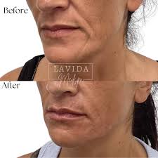 Abby Redwine BSN, RN (@abby_lavidamedspa) · Instagram 照片和视频