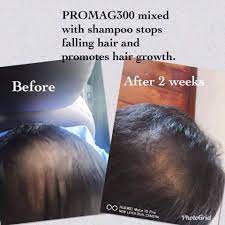 A report from the multidisciplinary androgen. For Hair Fall Promag300 Transdermal Magnesium Facebook