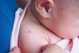 40% 34.75% 20 25 50 75 days after vaccination influenza vaccine effectiveness 100 125 150 0 0 years most vaccine durability estimates are based on tested antibody levels. Baby Vaccinations What Are The Side Effects Madeformums