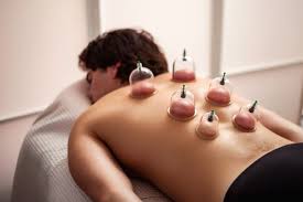 Everything You Need to Know About Hijama Cupping Therapy