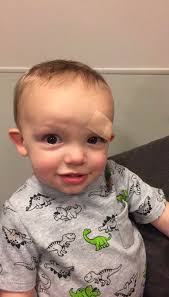 Necrotizing fasciitis from puncture wound