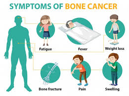 Signs and symptoms caused by cancer will vary depending on what part of the body is affected. Free Vector Medical Infographic Of Bone Cancer Symptoms