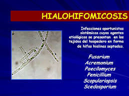 El propósito de este estudio es determinar si la adición del medicamento, deferasirox, a la terapia antifúngica estándar para la infección, la mucormicosis, es segura y eficaz. Hialohifomicosis Ecured
