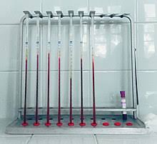 La vs représente la hauteur en mm du culot de cellules sédimentées, après 1 heure et 2?heures. Vitesse De Sedimentation Wikipedia