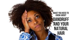 This is because dandruff can lead to hair thinning and may even cause damage to the follicles and so, what can a dandruff sufferer do to treat the root cause of the condition, while simultaneously. What You Need To Know About Dandruff And Your Natural Hair Wellbeing Arena