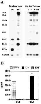Nahrávejte, sdílejte a stahujte zdarma. Systemic Sclerosis Th2 Cells Inhibit Collagen Production By Dermal Fibroblasts Via Membrane Associated Tumor Necrosis Factor A Chizzolini 2003 Arthritis Amp Rheumatism Wiley Online Library