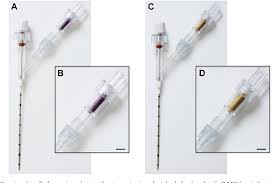 Image result for Colorimetric Capnometry