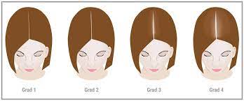 Symptome Von Haarausfall Bei Frauen In Der Menopause