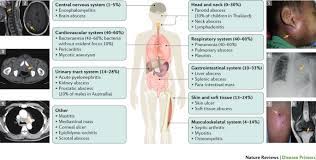 Melioidosis, also known as whitmore's disease, is an infectious disease that can infect humans or animals, the cdc explains. Melioidosis Nature Reviews Disease Primers