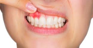 Why Do My Teeth Feel Weird